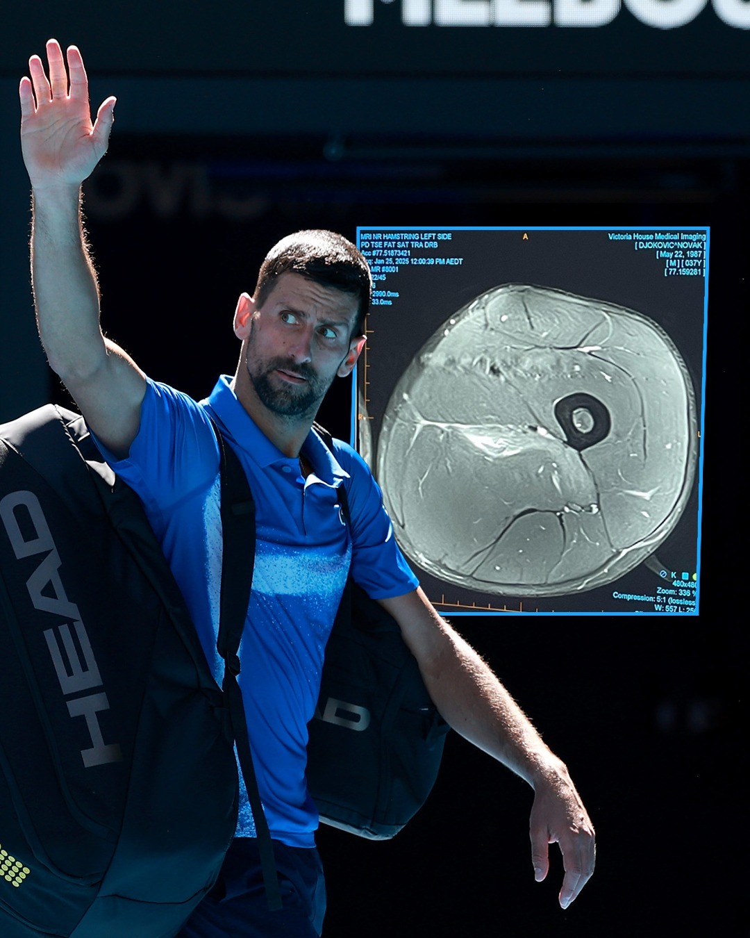 澳大利亚网球队逆转日本网球队，德约科维奇绝境逆转的简单介绍